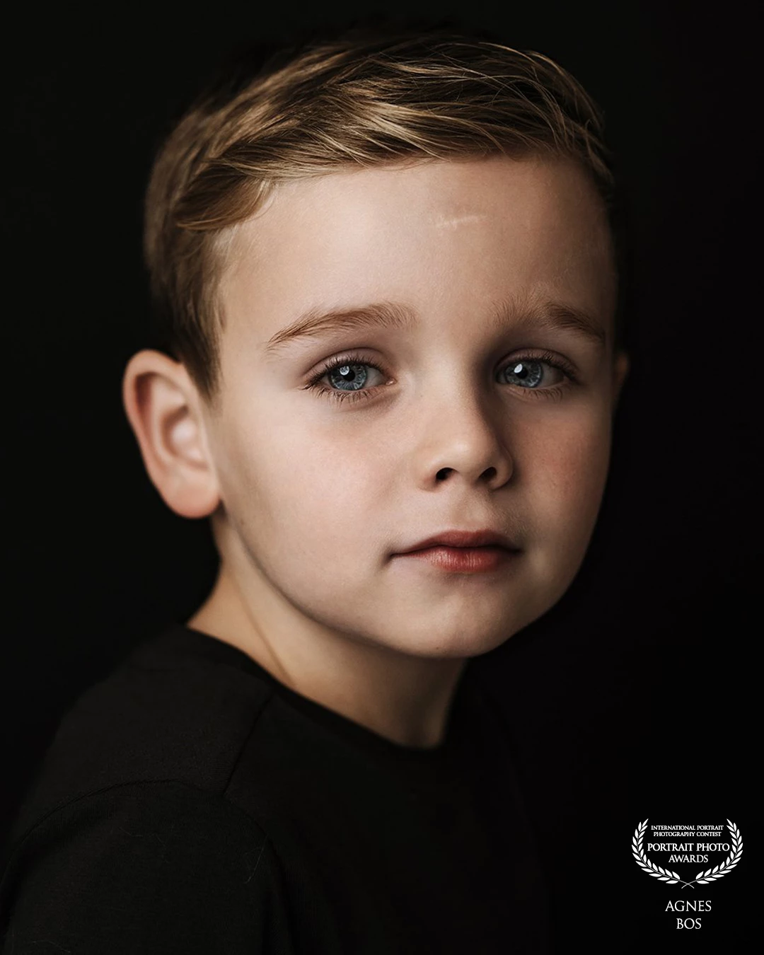 βA pure portrait where the eyes tell the story. A quiet strength, a touch of magic β and a little scar that makes him unique.β